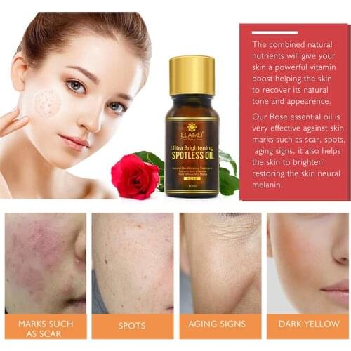 ELAIEMI 10ml Freckle Essence Rose Essential Oil Dark Spot Corrector Whitening Face Bleaching Serum Brighten Skin Face Care TSLM2