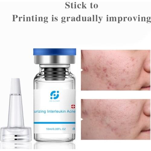 Acne Treatment serum Natural Extract Derma Roller Serum Mesotherapy Microneedle Scar Pimple Shrink Pores Acne Removal Serum