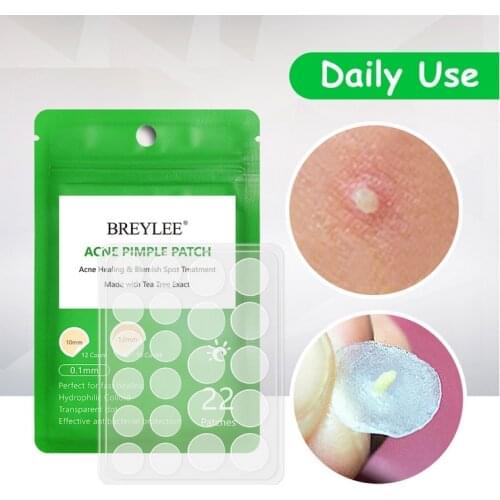 Acne Pimple Patch Facial Treatment Protects Invisible Acne Removal Blackhead Hydrocolloid Stickers Beauty Skin Care Tools