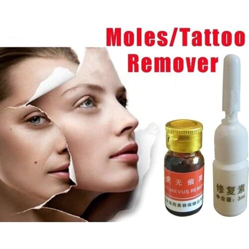Remove nevus and painless skin, remove facial nevus, remove black spots on skin, remove freckles.Free shipping