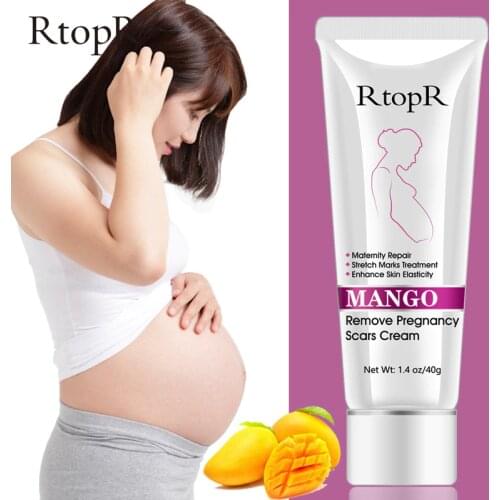 RTOPR Mango Remove Pregnancy Scars Acne Cream Stretch Marks Treatment Maternity Repair Anti-Aging Anti Winkle Firming Body Cream