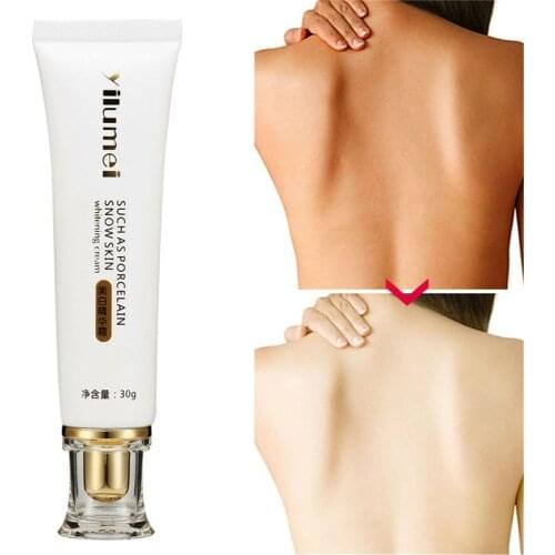 Whitening Cream Skin Bleaching Whole Body Lotion Legs Knees Private Parts Body Whitening Essence Cream