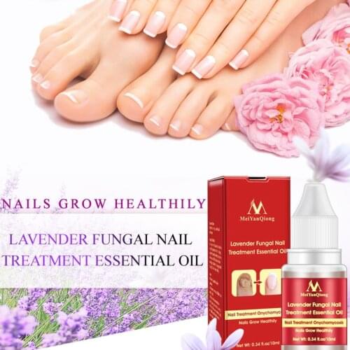 10ml Nail Fungus Treatment Anti Fungal Toenail Repair Care Lavender Essential Oil NN