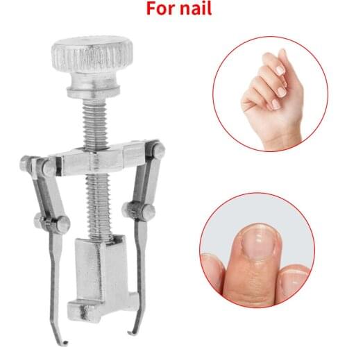 Professional Copper Ingrown Toenail Treatment Kit Toe Nail Correction Foot Care Correction Brace Tool Foot Care Tool