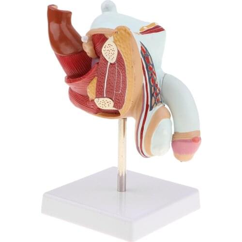 1:1 Human Male Diseased Reproduction Urinary System Pathlology Model