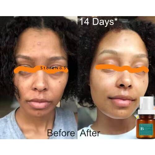 Skin whitening serum, glutathione whitening lightner serum for face, melanin blocker oils