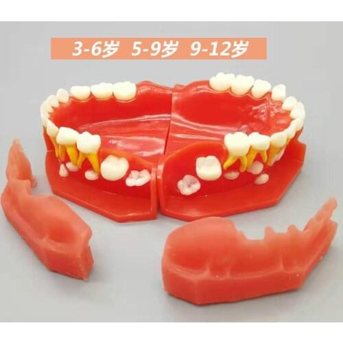Deciduous teeth and permanent teeth alternative model children show eruption and development of deciduous and permanent teeth