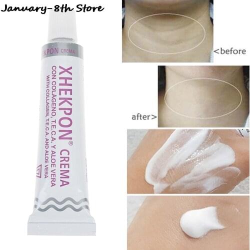 40G Nek Crème Xhekpon Crema Gezicht En Hals Crème 40Ml Hals Crème Rimpel Glad Anti Aging Whitening Cream