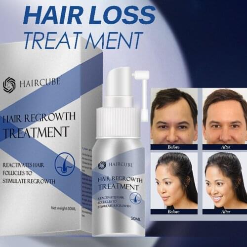 Hair Growth Spray Anti Hair Loss Products Hair Growth Products Prevent Hair Loss Treatment Essence Oil Hair Care Repair Serum