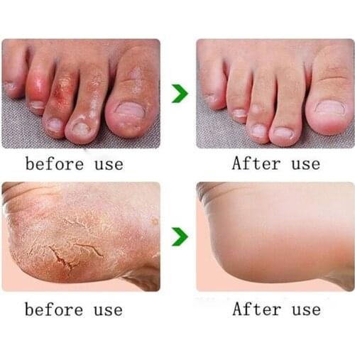 33g Anti Crack Foot Cream Dryness Foot Mask Heel Cracked Repair Cream Hand New