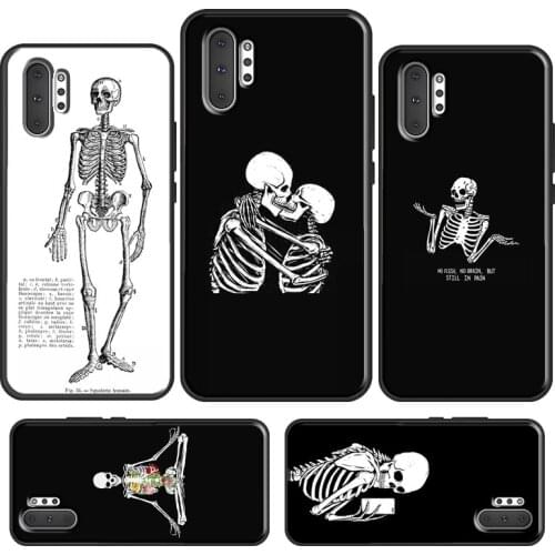 Skeleton Art Case For Samsung Galaxy S10 S8 S9 S20 S21 Plus Note 20 Ultra 10 9 S10e S20 FE Phone Cover