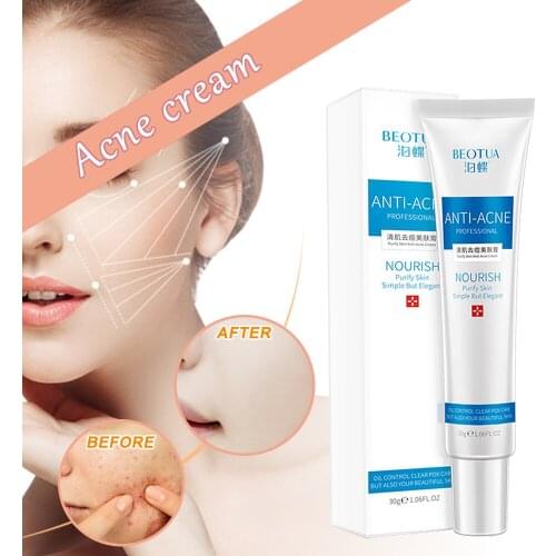 Blemish Cream Spots Removal Treatment Pimple Ointment Scar Mark
