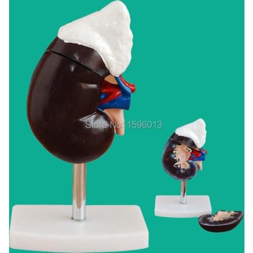 Human Kidney with Adrenal Gland Model 2 parts, Kidney and Adrenal Gland Model