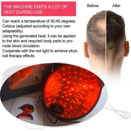 COZING-C96 Laser Hair Regrowth Equipment Growth Devices 650nm Laser Therapy Anti Hair Loss Cap
