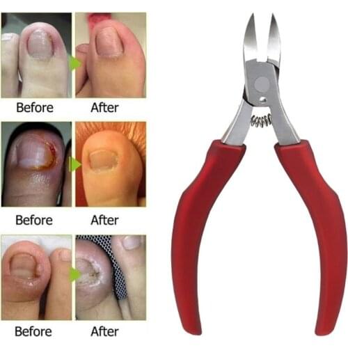 Beidol Nail Clippers