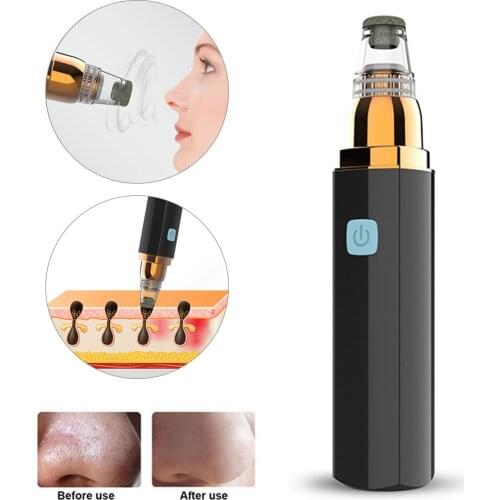 FRESHME Vacuum Pore Cleaners