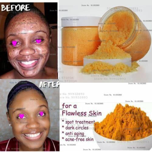 Tumeric Scrub, Dark Spots remover, clear skin, Spotless skin 60ml