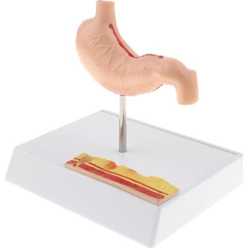 PVC Human Stomach Anatomical Showing Model with Base - Medical Anatomy Study Display Model Kit