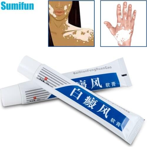 30g New VitiligoTreament Cream Antibacterial Cream Psoriasis Localized Vitiligo Ointment White Spot Mycosis Leukoplakia Treat