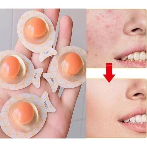 Egg Night Sleeping Mask Moisturizing Hydrating Shrinking Pores Acne Removal Oil Control 2-10PCS No-Clean Mask Brighten Skin Care