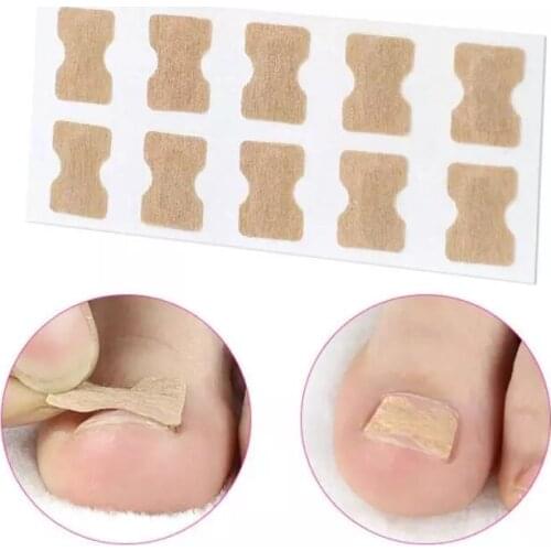 50 Non-Glue Toe Nail Patch Ingrown Toe Nail Correction Pedicure Tool Nail Strips Anti-roll Nail Free Glue Toe