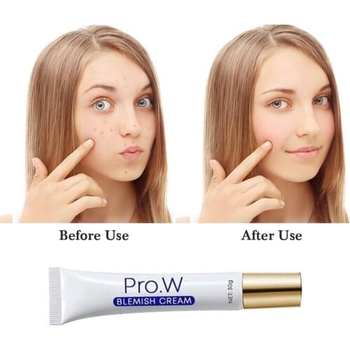 Pro.w Face Acne Treatment and Spot-Removing Cream Blackhead Removal Water-Oil Balance Shrink Pores Blemish Cream Skin Care