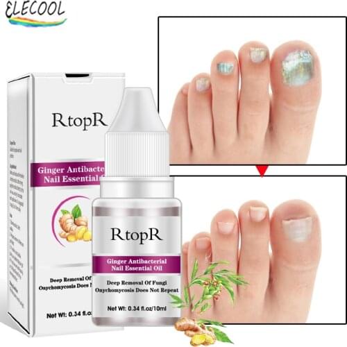 ELECOOL Fungal Nail Treatment Essential Oil Hand And Foot Whitening Toe Nail Fungus Removal Infection Feet Care Polish Nails Gel