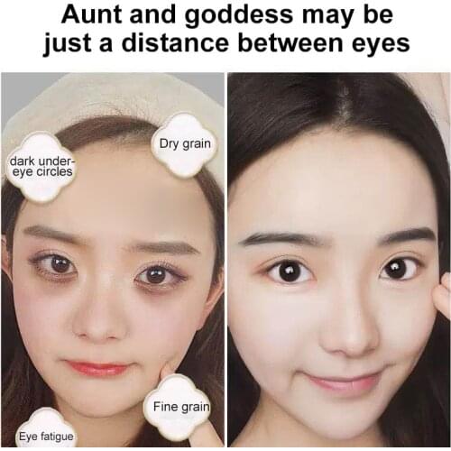 Hot! Eye Patch Hyaluronic Acids Microneedle Eye Pads Whitening Moisturizing Wrinkles Fine Lines Dark Circles Removal Eye Mask