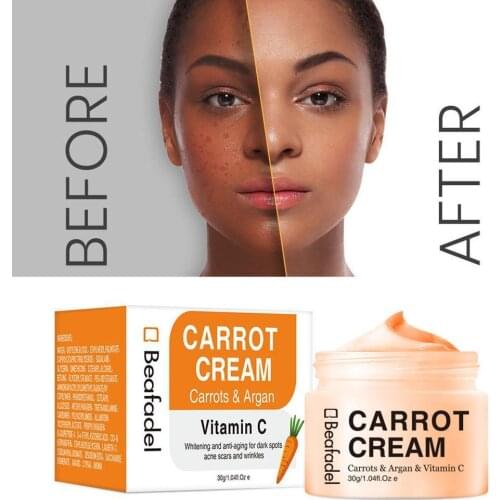 Facial Whitening Cream Carrot Cream Vitamin C Brightening Skin Tone And Freckle Natural Korean Skin Care Products