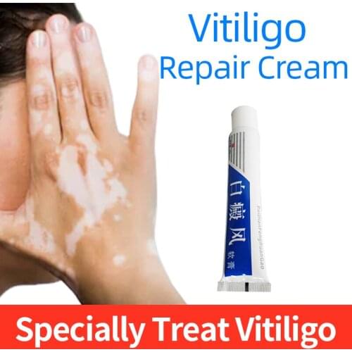 20g Vitiligo Repair Cream Treatment Leukoplakia Disease Chinese Medical Skin Care Plaster Promoting Pigment Melanin