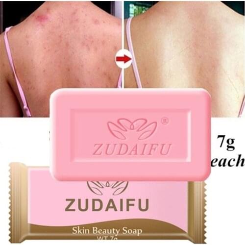 1/5pcs Zudaifu Sulfur Soap Anti-mites Anti-acne Body Cleansing Soap Skin Treatment Acne Psoriasis Seborrhea Eczema Anti Fungus