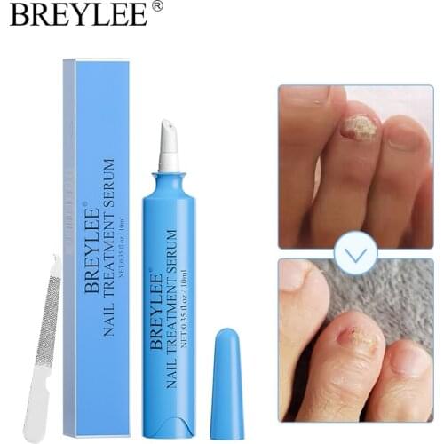 10ml Fungus Nail Repair Gel Pen Anti-Fungal Infection Serum Promote Toe Nails Growth Onychomycosis Paronychia Hand Foot Care