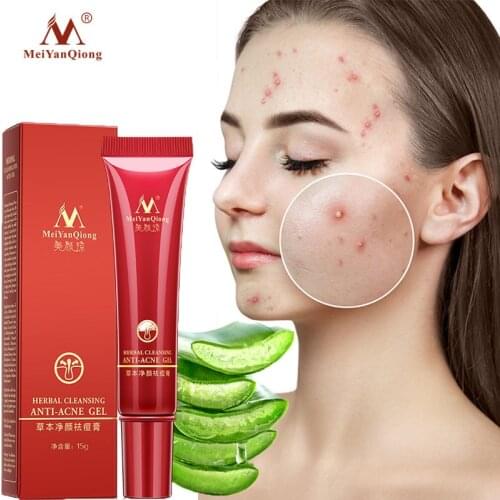 Herbal Acne Treatment Cream Remove Acne Pimples Dark Spots Shrink Pores Anti-acne Serum Nourish Whitening Moisturizing Skin Care
