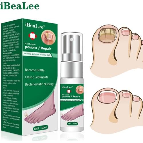 IBeaLee Fungal Nail Treatment Feet Care Essence Nail Fungas Foot Repair Toe Nail Fungus Removal Gel Paronychia Onychomycosis
