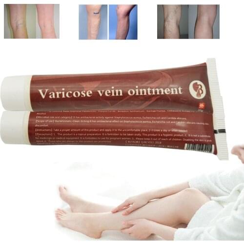 10pcs Varicose Veins Treatment Ointment Vasculitis Phlebitis Angiitis Inflammation Blood vessel Rotten legs Varicose Veins Cream