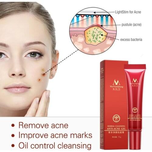 High Quality Herbal Cleansing Face Anti acne treatment cream Herbal scar removal oily skin Acne Spots skin care face