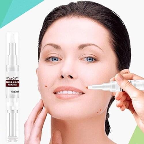 10ml Skin Tags Moles Remover Pen Facial Body Hand Freckle Wart Dark Spot Blackhead Blemish Pimple Treatment Liquid Ointment