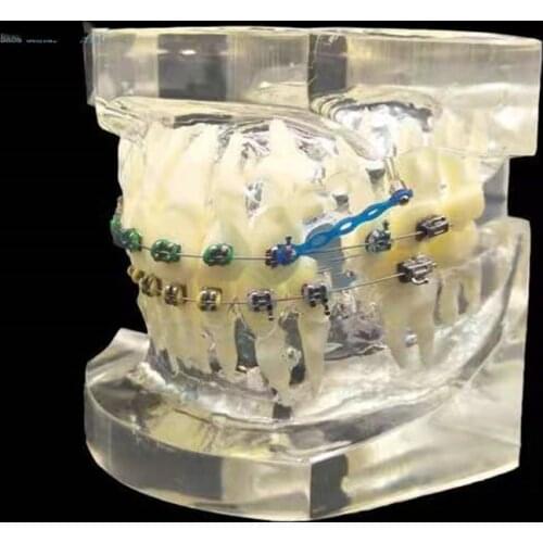 Wrong Jaw correction Teaching Tooth Model M3005/ Various Dental Teeth Models Are Used For Teaching And Hospital Dentist Material