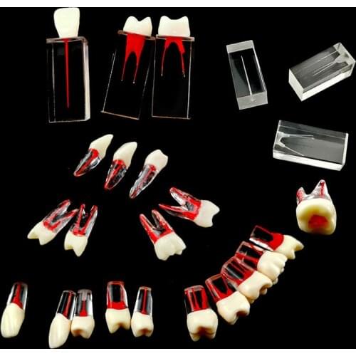 Dental Tooth Model Root Canal Pulp Cavity Clear Resin Teaching Teeth Model for Student Study Lab Equipmenent