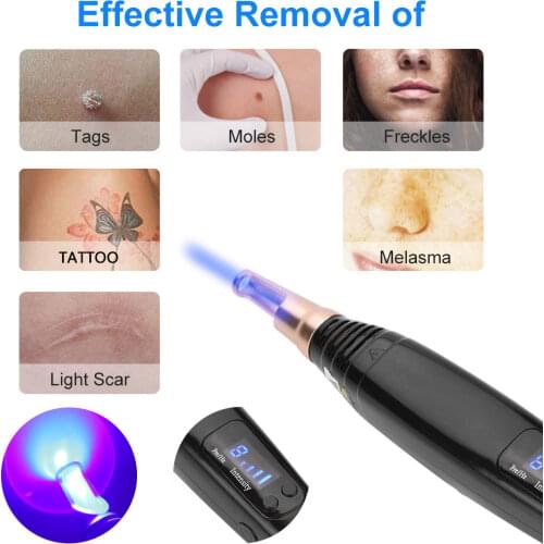 Black Facial Laser Beauty Pen, Melanin Spot Removal Laser Gun Electric Home Beauty Machine Effectively Remove Freckles Acne Mole