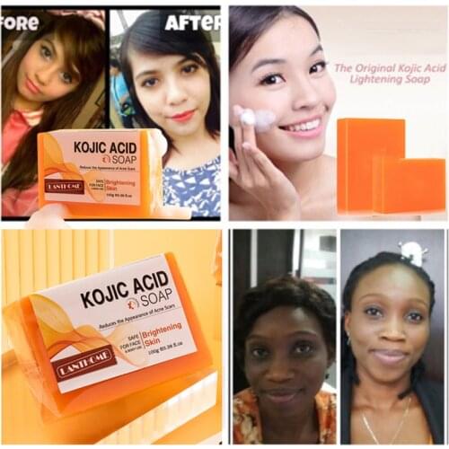 Dark Black Skin Lightening Soap Kojic Acid Whitening Soap Kojic Acid Glycerin Brighten Face Body Skin Bleaching Turmeric Soap