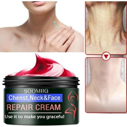 10g/30g/50g Eelhoe Whitening Anti Cream Moisturizing Anti-aging Anti Hydrating Cream Care