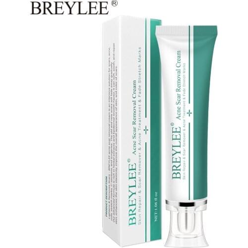 BREYLEE Removal Scar Cream Face Pimples Scar Stretch Marks Removal Acne Treatment Whitening Moisturizing Cream Skin Care 30g