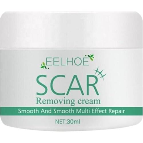 30ml Acne Scar Removal Cream Acne Spots Acne Treatment Skin Care Acne Spots Acne Treatment Blackhead Whitening Skin