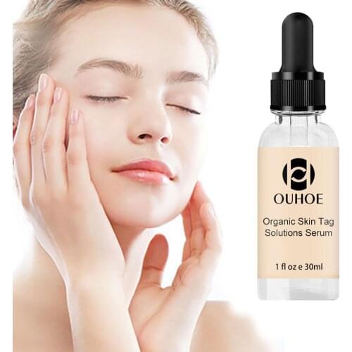 Wart Mole Remover Liquid Non-marking Organic Tags Solutions Serum Skin Tag Mole Freckle Spot Fast Remover Essence Skin Care