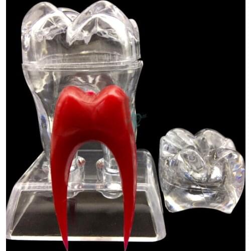 Dental 4 Times Crystal Base Hard Plastic Teeth Tooth Molar Model Separable