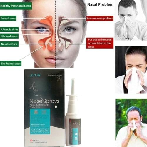 30ml/bottle Nasal Fluid Dressing Spray Chronic Rhinitis Sinusitis Herbal Treatment Chinese Rhinitis Nose Health Spray Spray X9E4