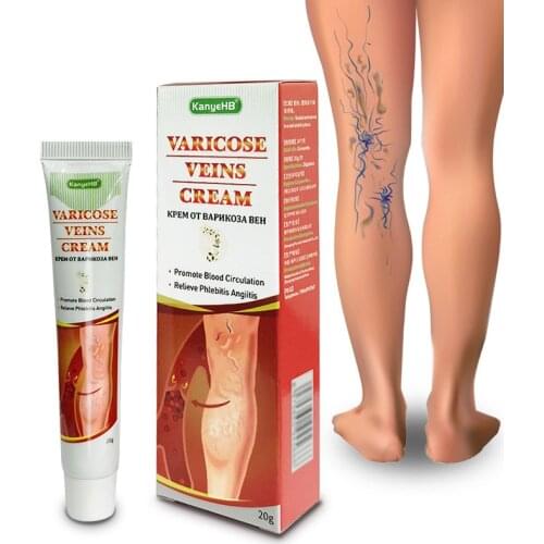 1pcs ointment effective treatment of varicocele in the scrotum Leg Varicose Veins Treatment Cream