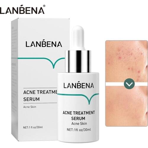 LANBENA Acne Treatment Serum Oilgopeptide Anti Acne Solution Reduce Mark Shrink Pores Deep Repair Strengthen Skin Bottom 30ML