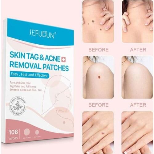 108Pcs/Box Beauty Acne Patch Skin Care Face Pimple Blemish Remover Sticker Cover Invisible Patches Skin Tag Care Tools